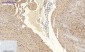 Bad Polyclonal Antibody